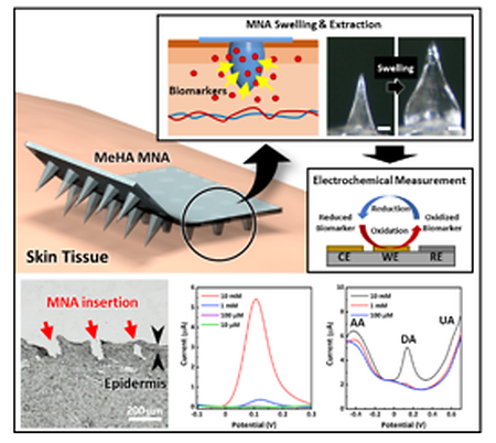 Swellable hydrogel-based microneedle sensor for biomolecules detection (2022.03.01)