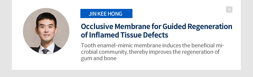 Occlusive Membrane for Guided Regeneration of Inflamed Tissue Defects